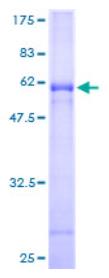 SDS-PAGE (CLEC10A-1451H).jpg